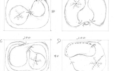 Les premiers dessins